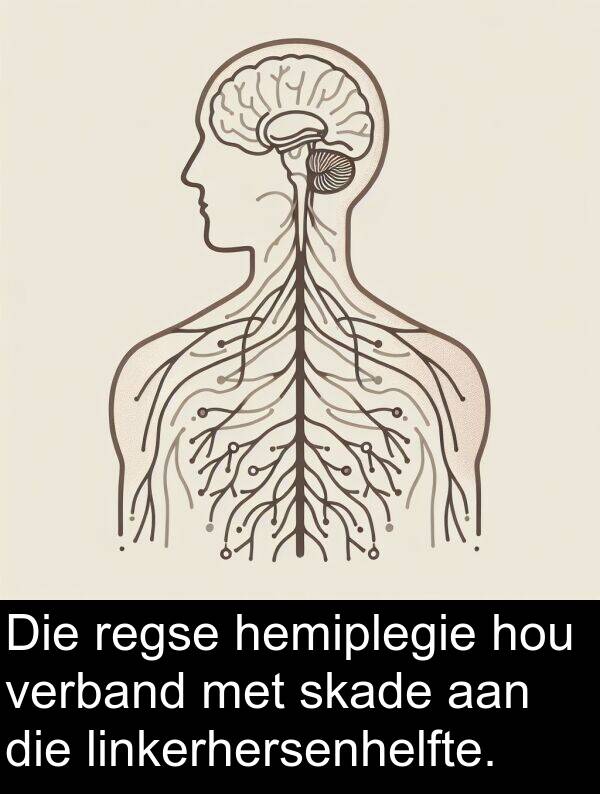 hemiplegie: Die regse hemiplegie hou verband met skade aan die linkerhersenhelfte.