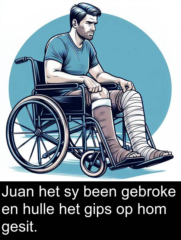 hulle: Juan het sy been gebroke en hulle het gips op hom gesit.