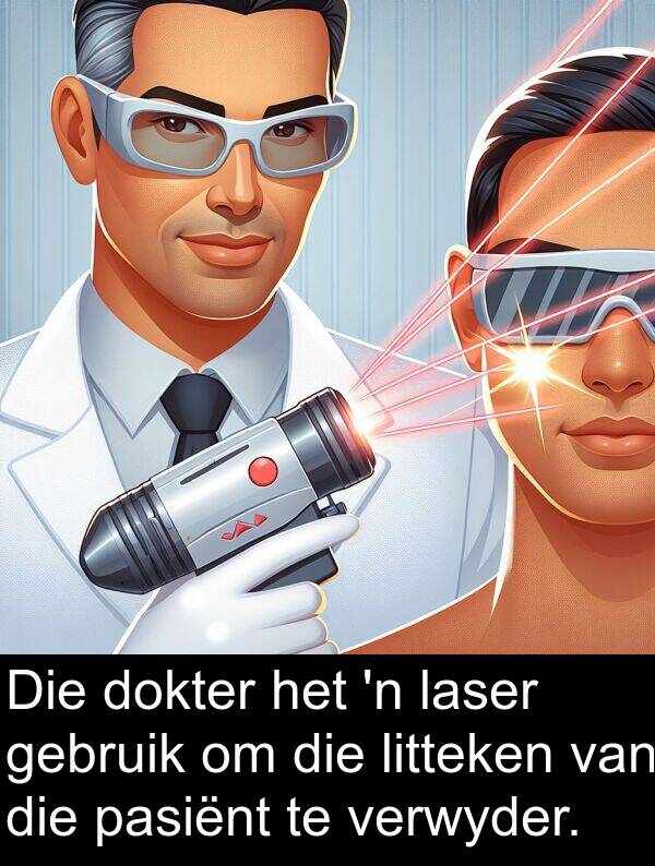 pasiënt: Die dokter het 'n laser gebruik om die litteken van die pasiënt te verwyder.