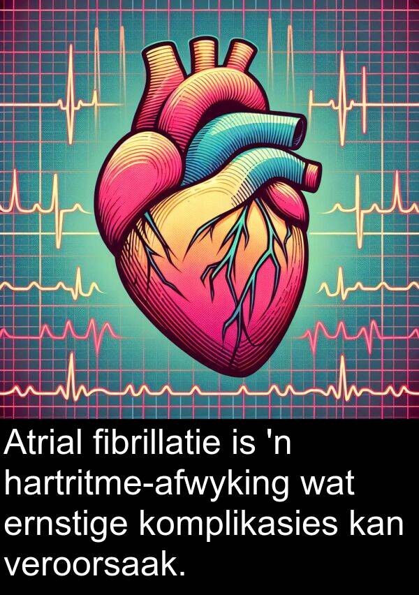 veroorsaak: Atrial fibrillatie is 'n hartritme-afwyking wat ernstige komplikasies kan veroorsaak.