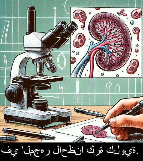 كرة: في المجهر لاحظنا كرة كلوية.