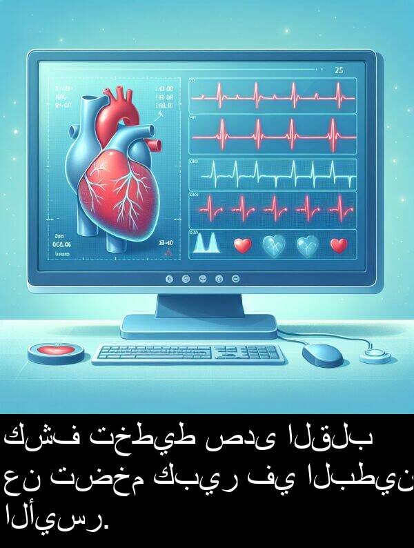 كبير: كشف تخطيط صدى القلب عن تضخم كبير في البطين الأيسر.