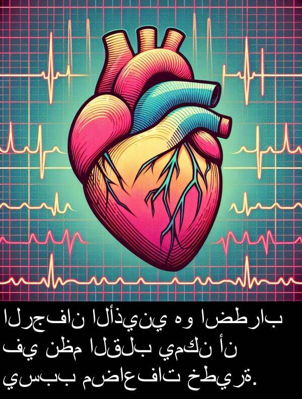 خطيرة: الرجفان الأذيني هو اضطراب في نظم القلب يمكن أن يسبب مضاعفات خطيرة.