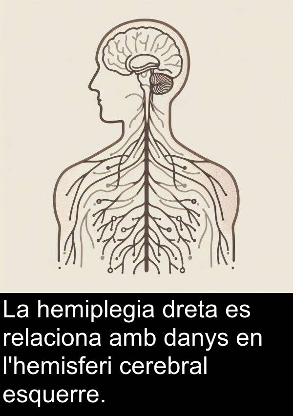 danys: La hemiplegia dreta es relaciona amb danys en l'hemisferi cerebral esquerre.