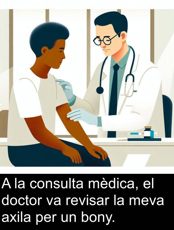 bony: A la consulta mèdica, el doctor va revisar la meva axila per un bony.