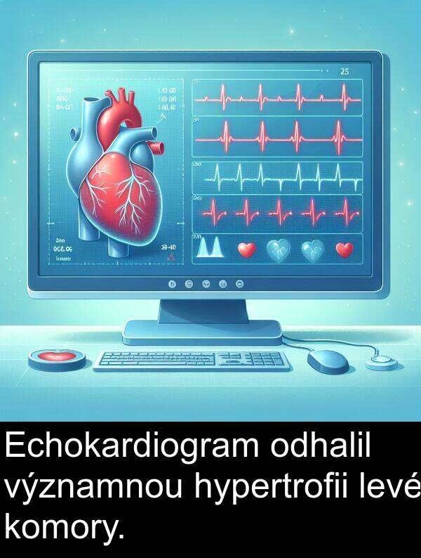 levé: Echokardiogram odhalil významnou hypertrofii levé komory.