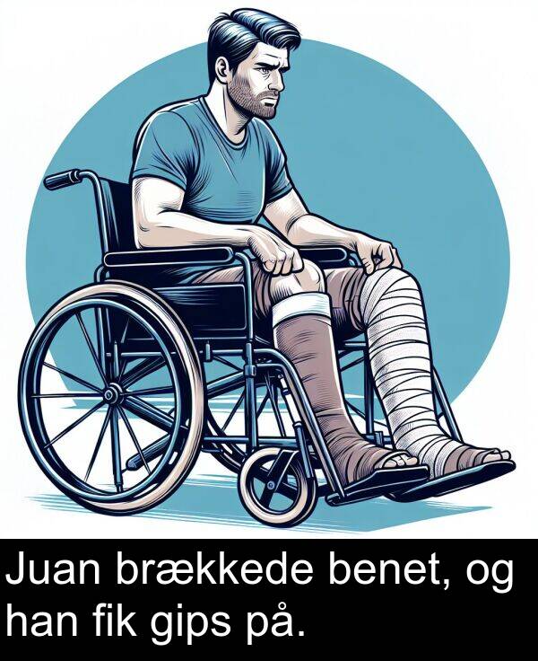 fik: Juan brækkede benet, og han fik gips på.