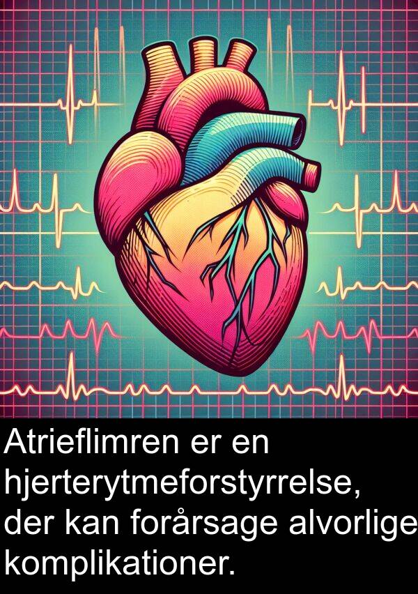 forårsage: Atrieflimren er en hjerterytmeforstyrrelse, der kan forårsage alvorlige komplikationer.