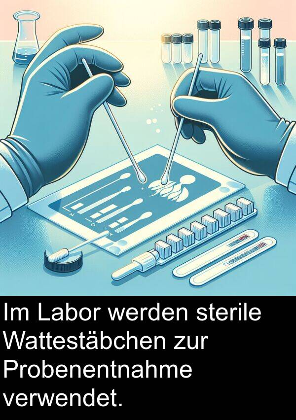 Labor: Im Labor werden sterile Wattestäbchen zur Probenentnahme verwendet.