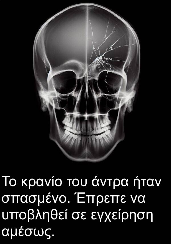 αμέσως: Το κρανίο του άντρα ήταν σπασμένο. Έπρεπε να υποβληθεί σε εγχείρηση αμέσως.