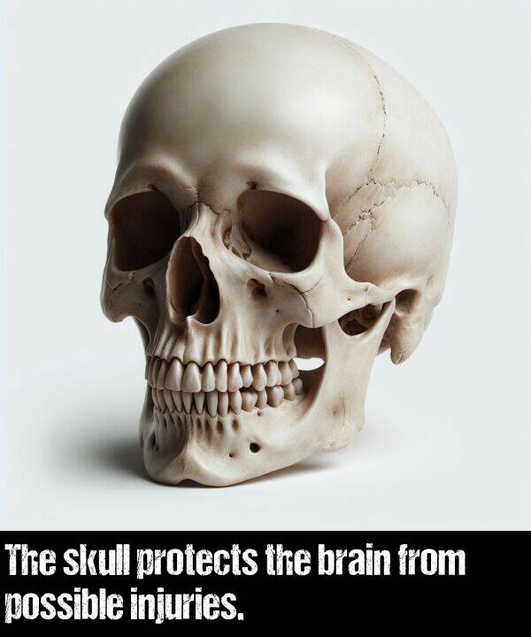 protects: The skull protects the brain from possible injuries.