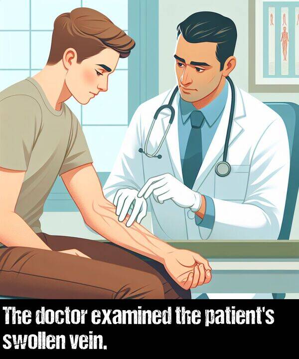 examined: The doctor examined the patient's swollen vein.