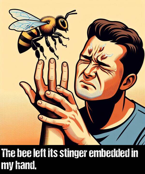 its: The bee left its stinger embedded in my hand.