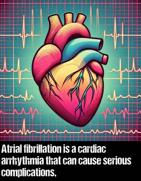 cause: Atrial fibrillation is a cardiac arrhythmia that can cause serious complications.