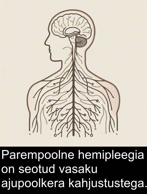 vasaku: Parempoolne hemipleegia on seotud vasaku ajupoolkera kahjustustega.