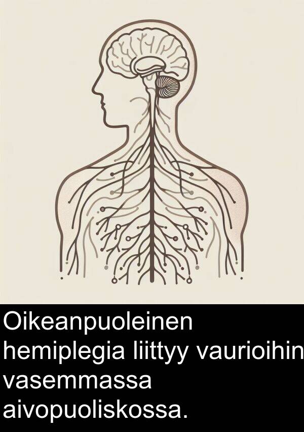 hemiplegia: Oikeanpuoleinen hemiplegia liittyy vaurioihin vasemmassa aivopuoliskossa.