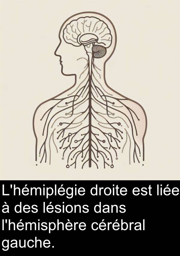 lésions: L'hémiplégie droite est liée à des lésions dans l'hémisphère cérébral gauche.