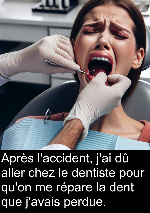 aller: Après l'accident, j'ai dû aller chez le dentiste pour qu'on me répare la dent que j'avais perdue.