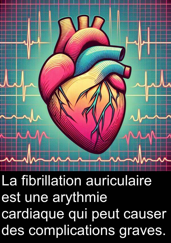 auriculaire: La fibrillation auriculaire est une arythmie cardiaque qui peut causer des complications graves.