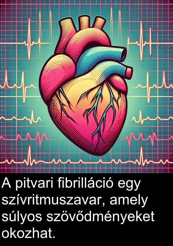 fibrilláció: A pitvari fibrilláció egy szívritmuszavar, amely súlyos szövődményeket okozhat.