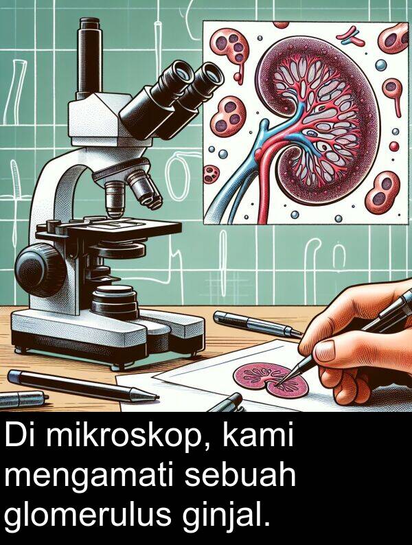 kami: Di mikroskop, kami mengamati sebuah glomerulus ginjal.