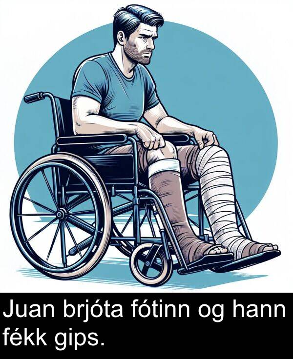 hann: Juan brjóta fótinn og hann fékk gips.