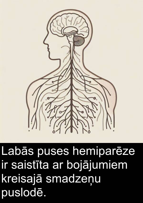 saistīta: Labās puses hemiparēze ir saistīta ar bojājumiem kreisajā smadzeņu puslodē.