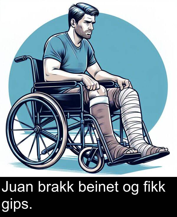 beinet: Juan brakk beinet og fikk gips.