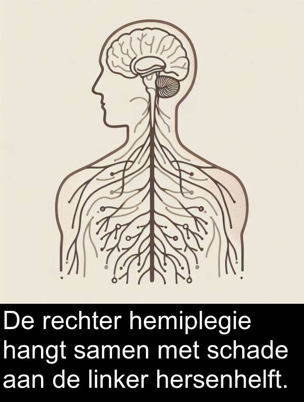 samen: De rechter hemiplegie hangt samen met schade aan de linker hersenhelft.