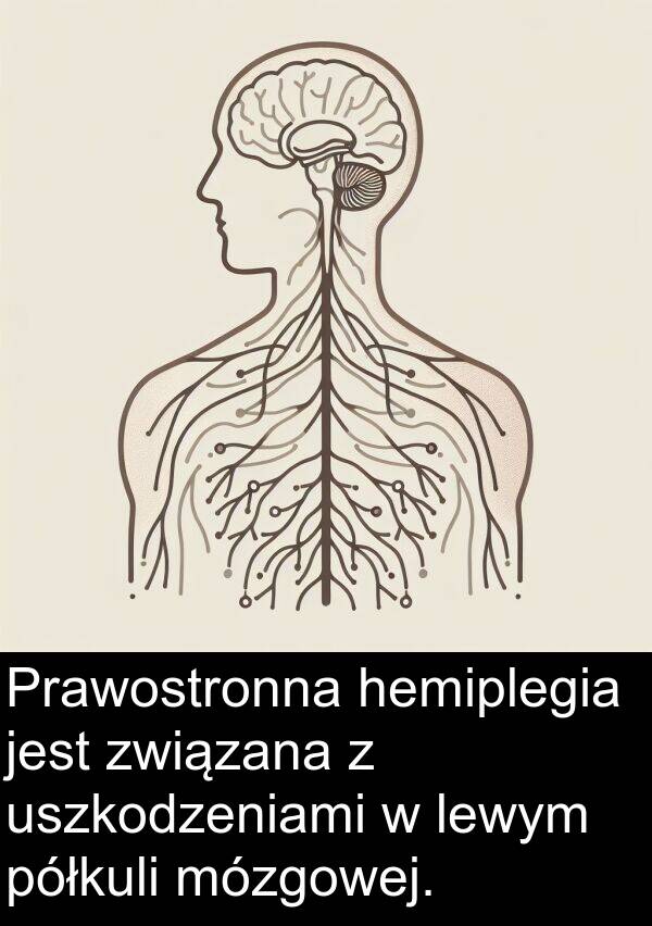 uszkodzeniami: Prawostronna hemiplegia jest związana z uszkodzeniami w lewym półkuli mózgowej.