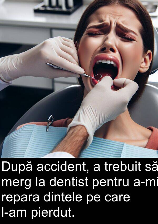 accident: După accident, a trebuit să merg la dentist pentru a-mi repara dintele pe care l-am pierdut.