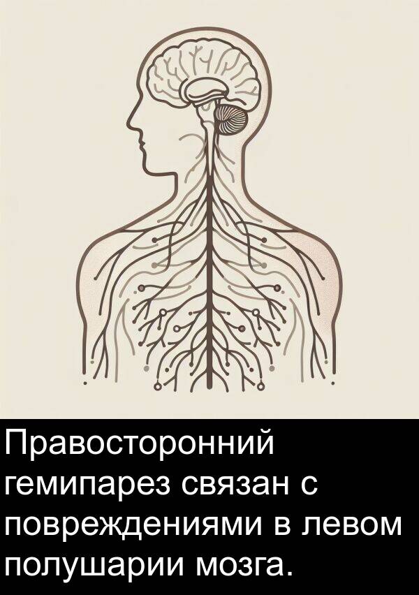 связан: Правосторонний гемипарез связан с повреждениями в левом полушарии мозга.