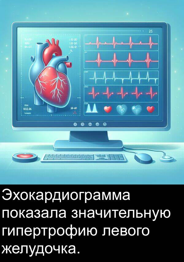 левого: Эхокардиограмма показала значительную гипертрофию левого желудочка.