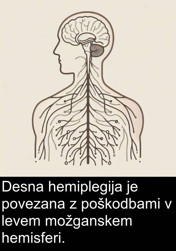 povezana: Desna hemiplegija je povezana z poškodbami v levem možganskem hemisferi.