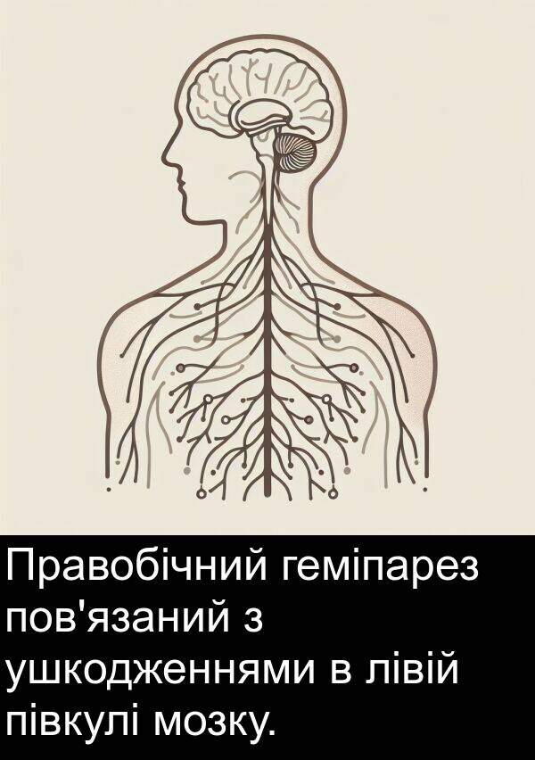 півкулі: Правобічний геміпарез пов'язаний з ушкодженнями в лівій півкулі мозку.
