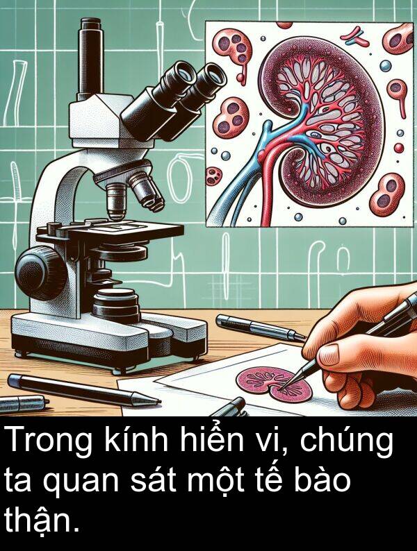 thận: Trong kính hiển vi, chúng ta quan sát một tế bào thận.